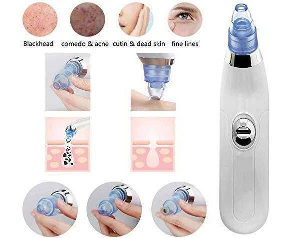 Blackhead Removal Machine | Derma Suction 3 In 1